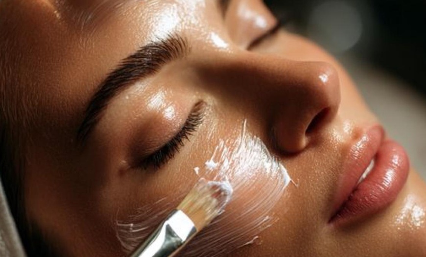 Image 1: Microneedling für das Gesicht mit optionalem BB-Glow für 1 Person