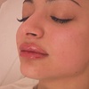 Image 4: Enhance Your Lips with 0.5ml or 1ml Lip Filler with Consultation