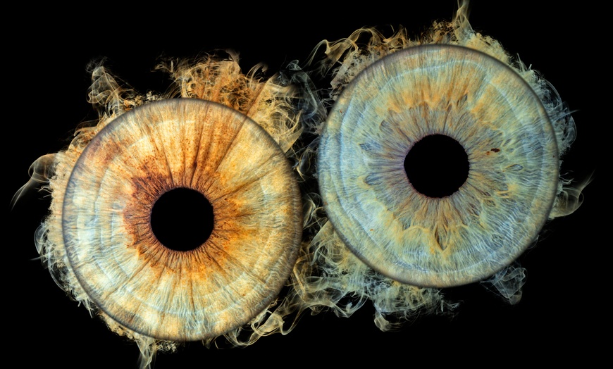 Image 1: La photo de votre iris en solo ou duo avec Ikomiris Caen
