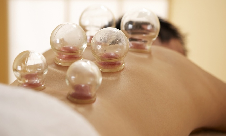 Image 3: Up to 50% Off on Acupuncture at Doris DWQC Acupuncture PC