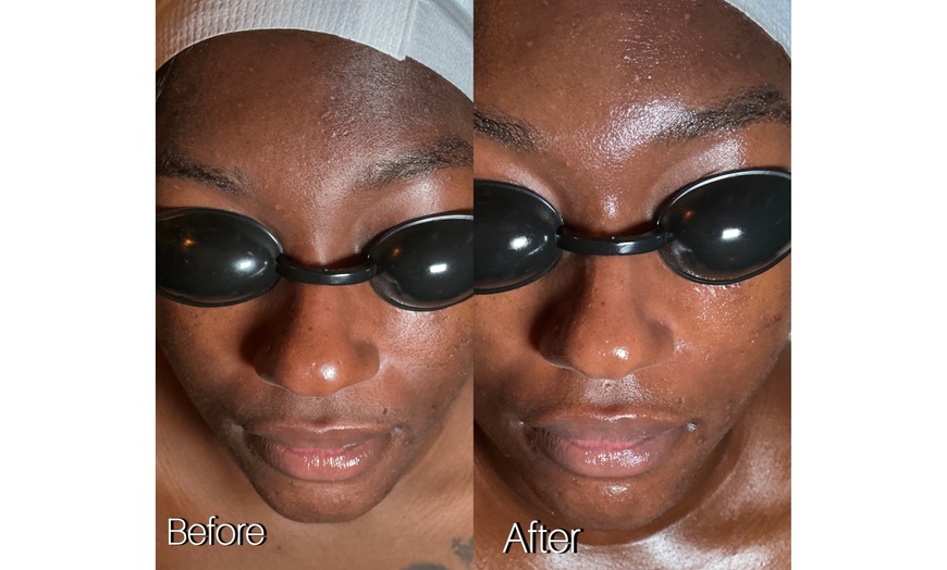 Image 3: Up to 55% Off on Spa / Salon Beauty Treatments at Oh my glow llc