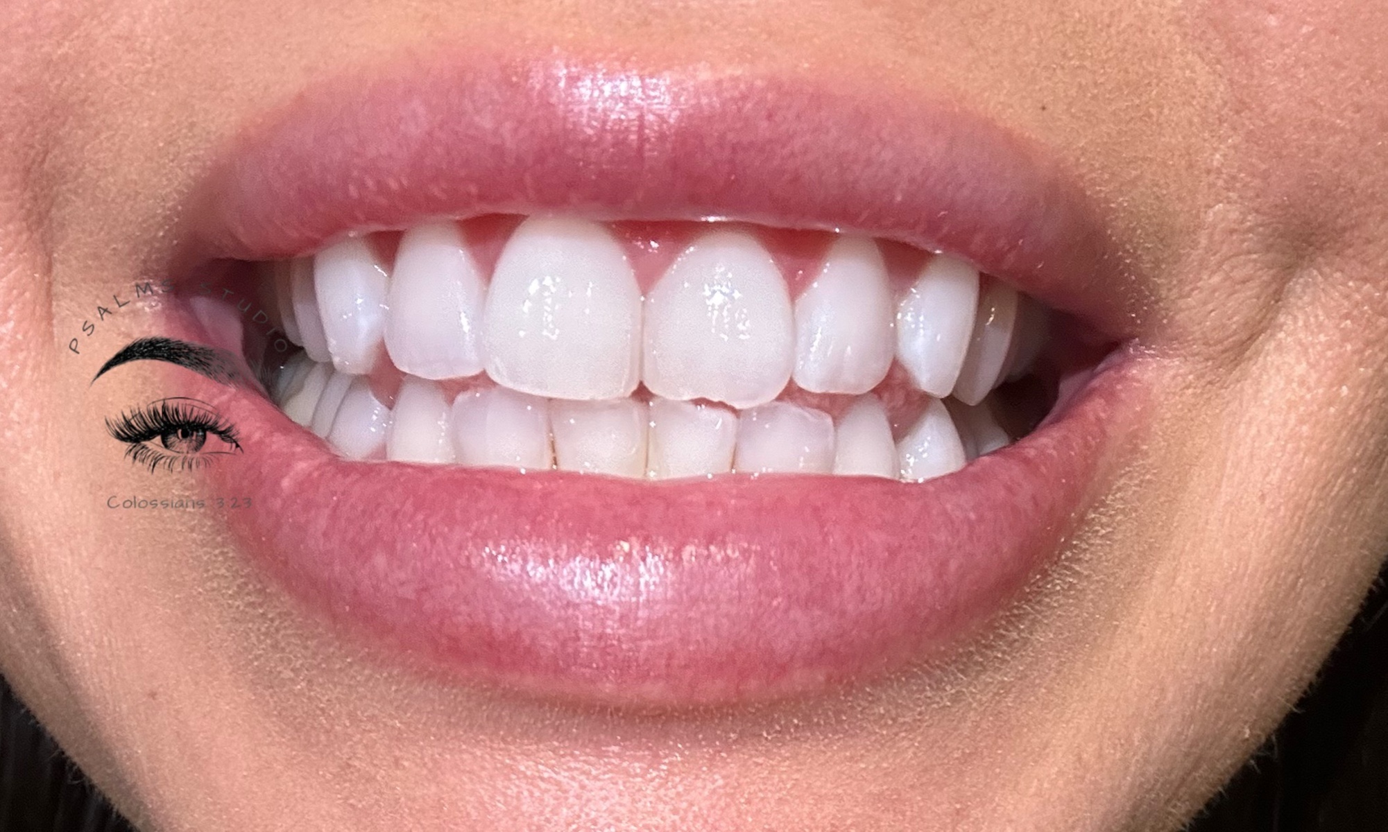 Up to 50% Off on Teeth Whitening at Psalms Studio