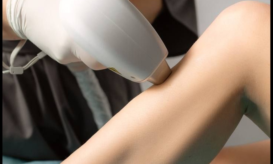 Image 4: 6 Soprano Laser Hair Removal Sessions on One Small, Medium, Large Area