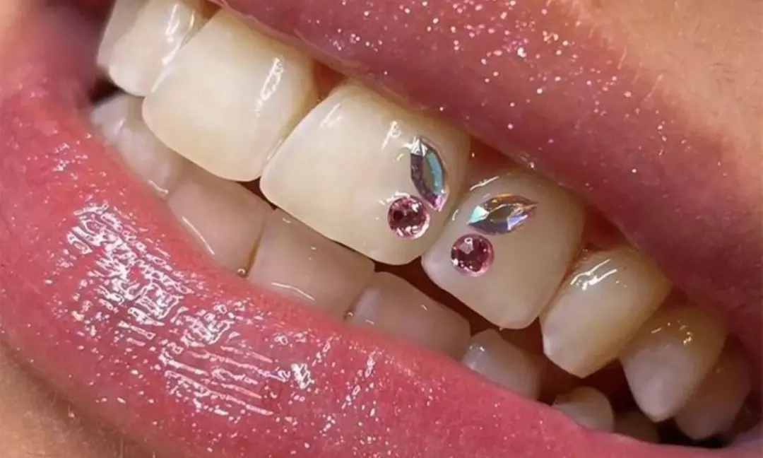 Brighten Your Smile with Tooth Gems