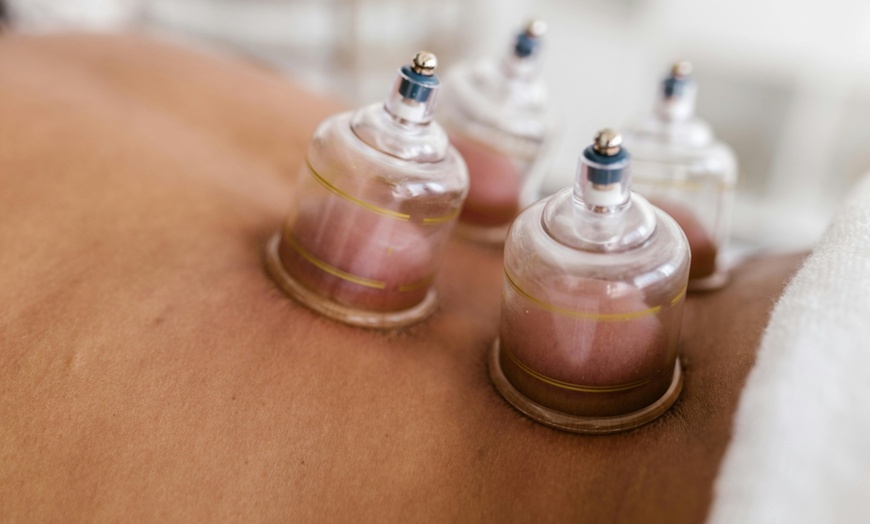 Image 3: Revitalize with 1 or 3 Acuwave Detox Cupping Sessions for 30 Mins
