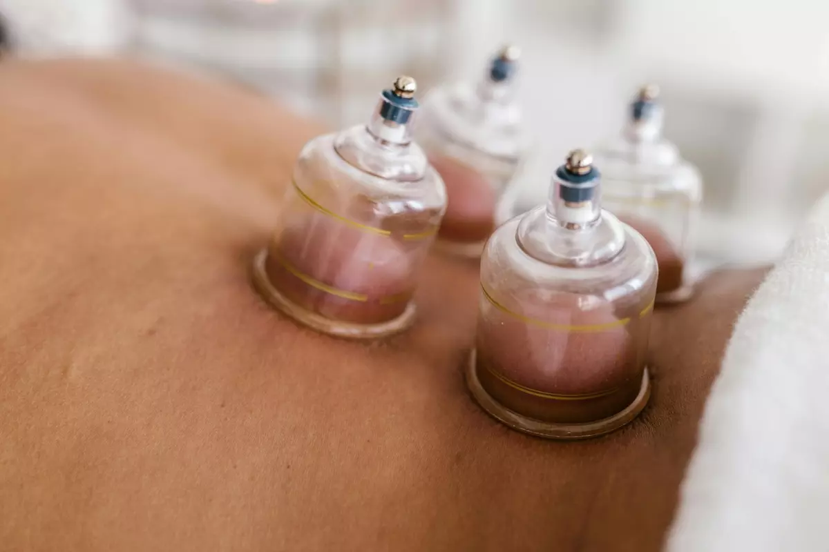 Revitalize with 1 or 3 Acuwave Detox Cupping Sessions for 30 Mins