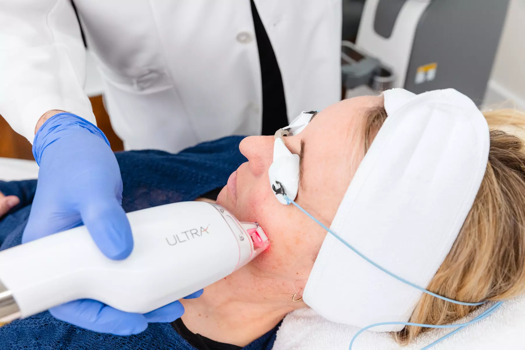 Non-Ablative Fractional Laser - LaseMD Ultra for Stretch Marks, Face, Neck, or Hands at Loma Laser (Up to  45% Off)