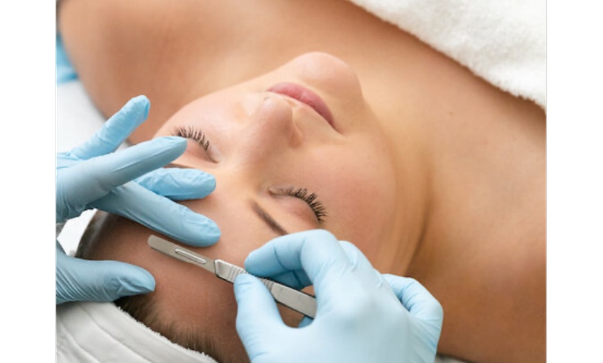 Image 3: Up to 58% Off on Micro-Needling at Refined Radiance Aesthetics, Westlake Village