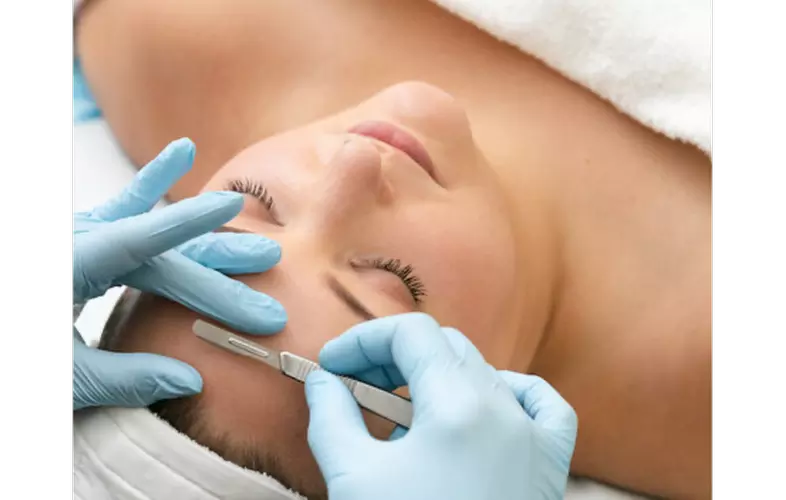 Up to 53% Off on Micro-Needling at Refined Radiance Aesthetics, Westlake Village