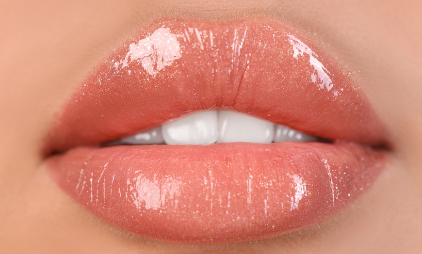 Image 2: 0.55ml to 2ml Juvéderm Dermal Filler Injection on One Area (Up to 83% Off)