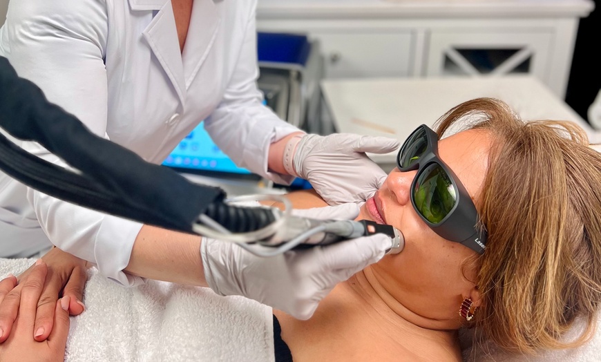 Image 3: Three or Six Laser Hair Removal Sessions for a Small or Medium Areas