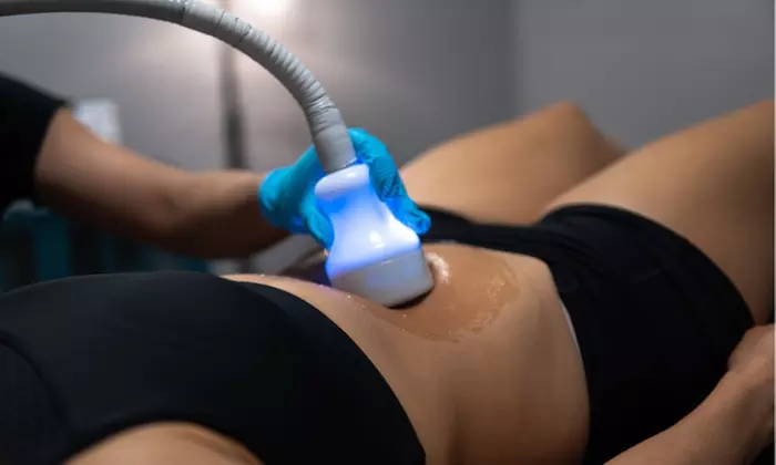 Experience Shape's body sculpting with packages of up to 10 treatments, and enjoy up to 80% off the original price - Primary Image