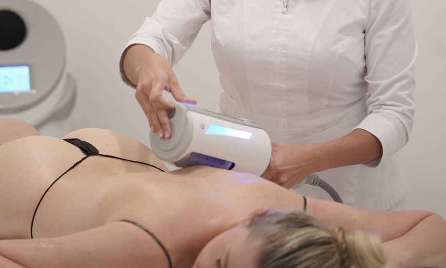 Image 7: Up to 55% Off on Endermologie at Love Your Body Endermologie  West Hollywood