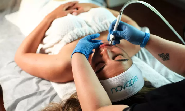 Up to 40% Off on Facial - Diamond Peeling at NovaPiel Med Spa - Primary Image