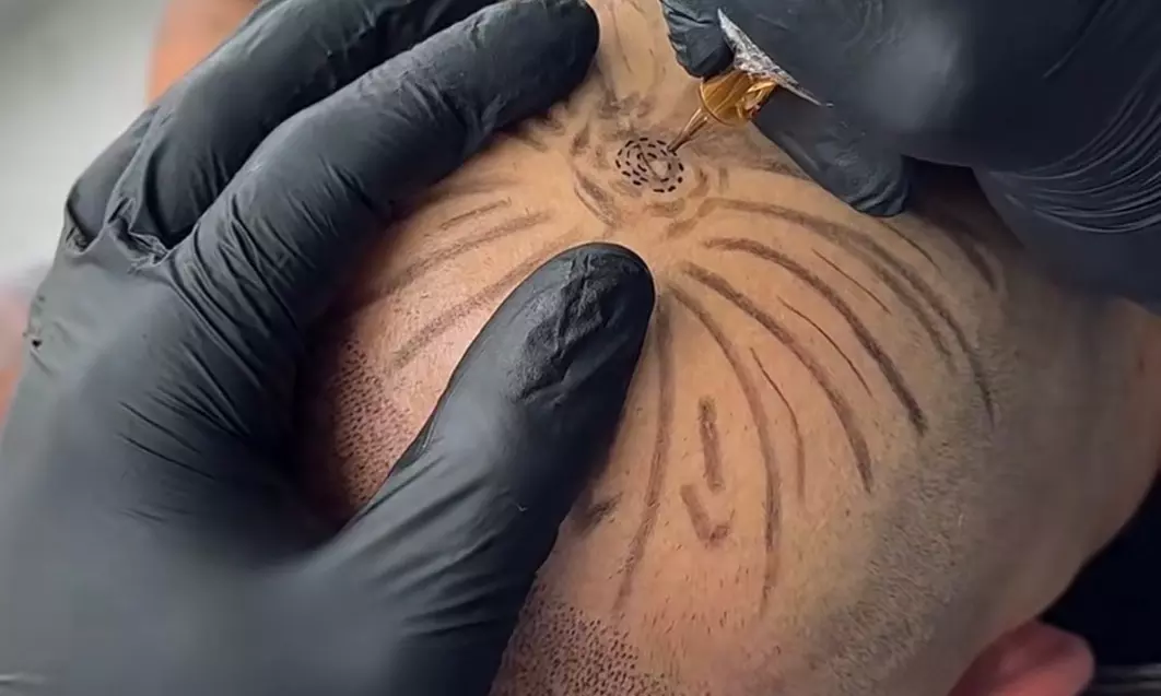 SMP Consultation w/ Hairline Focus, Density Boost for Hair Loss w/Care