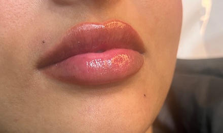 REVOLAX Dermal Filler - Includes Consultation - 1ml - ChloBella Aesthetics