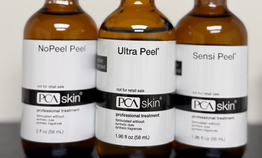 Image 4: Enhance Your Glow with 1, 2, or 3 Chemical Peels