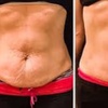 Image 1: Redefine Body with One, Four or Eight Fat Reduction Sessions
