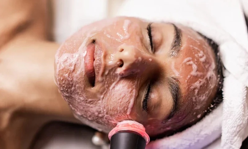 Image 3: Up to 40% Off on Facial - Oxygen at JENNVIE Med Spa