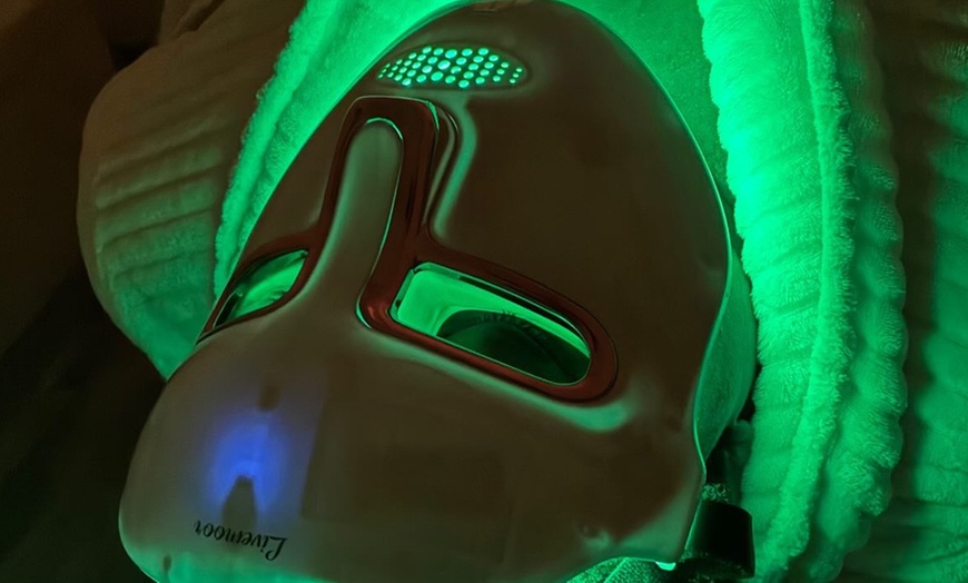 Image 2: Microdermabrasion Facials for Skin Rejuvenation