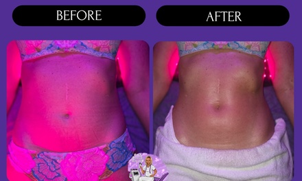 60 minute LYMPHATIC DRAINAGE MASSAGE WITH WOOD THERAPY - Get Me Bodied By Shay LLC