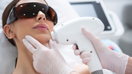 Six Sessions of Laser Hair Removal on X-Small Area - Sasha Aesthetics