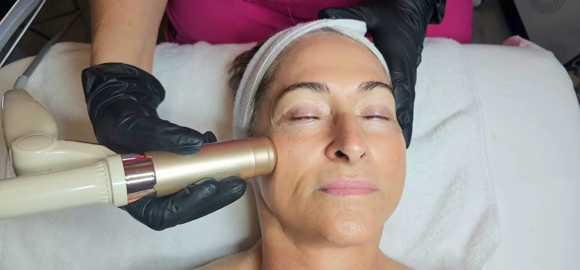 Lift & Tighten: HIFU/Ultherapy for Upper Face, Double Chin, or Neck