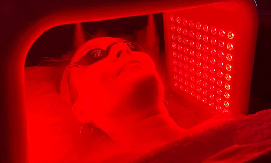 Image 5: Up to 54% Off on HydraFacial at Kolcheva Skin and Laser clinic