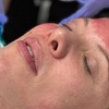 Image 3: Up to 63% Off on Micro-Needling at R3 Anti Aging & Medspa