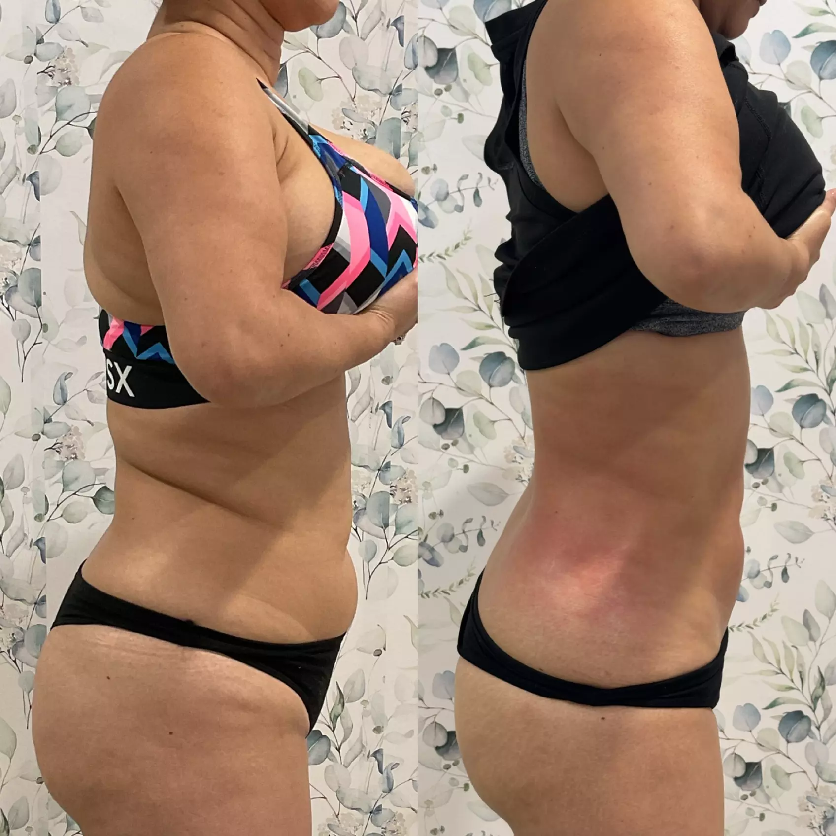 Up to 51% Off on Ultrasonic Fat Reduction at Soleil med spa