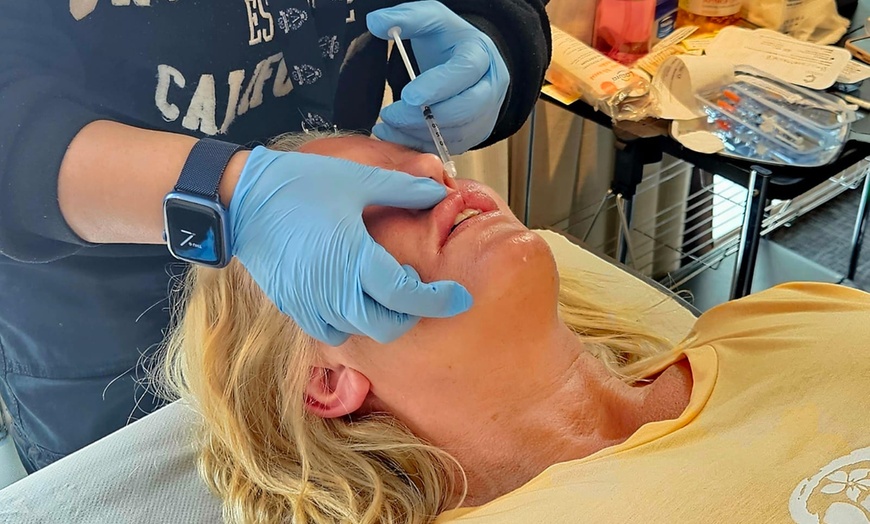 Image 4: Up to 25% Off on Injection - Dermal Filler at My Aesthetic Lounge