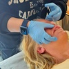 Image 4: Up to 25% Off on Injection - Dermal Filler at My Aesthetic Lounge