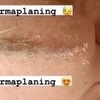 Image 3: Up to 35% Off on Facial at Angie Esthetic Center