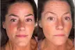 Up to 70% Off on Permanent Makeup at ML ESTHETICS - Second Medium