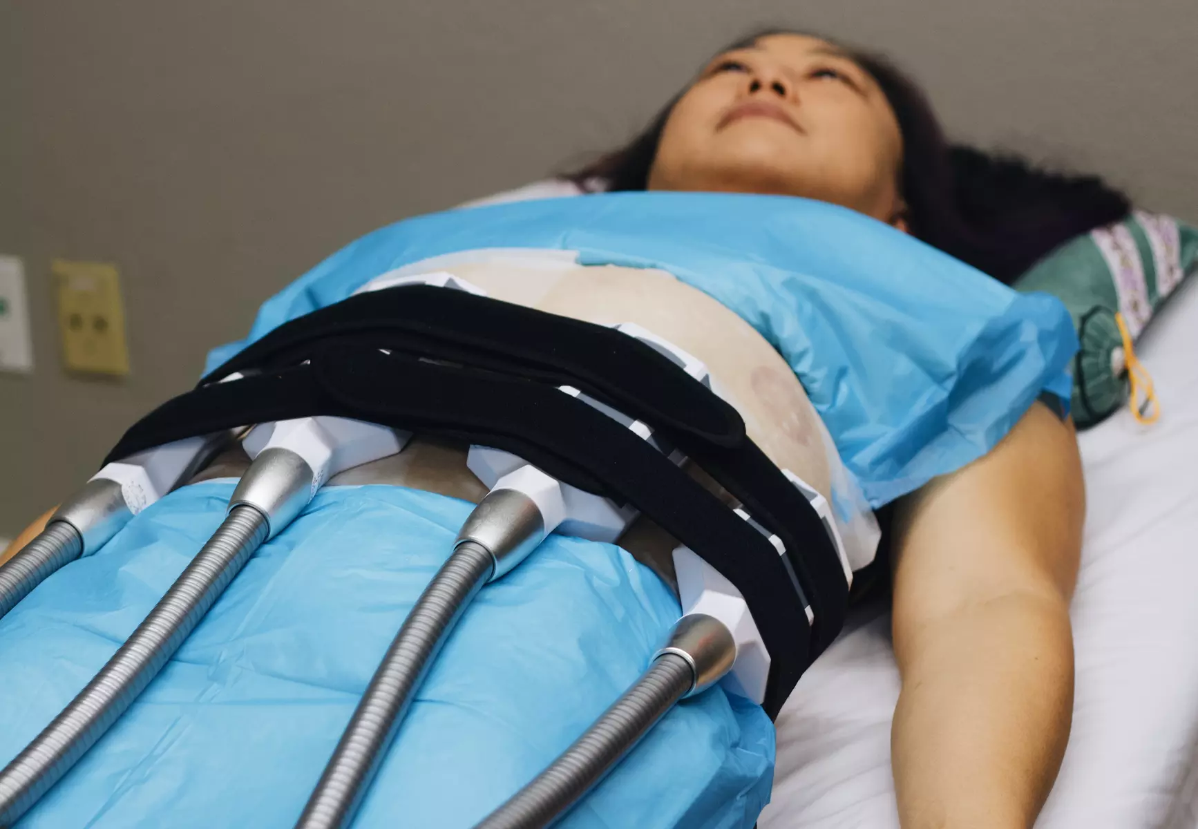 Rejuvenate Your Body: Cryotherapy, Acupuncture and More