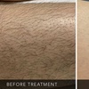 Image 4: Up to 50% Off on Laser Hair Removal at The Glam House Clinic