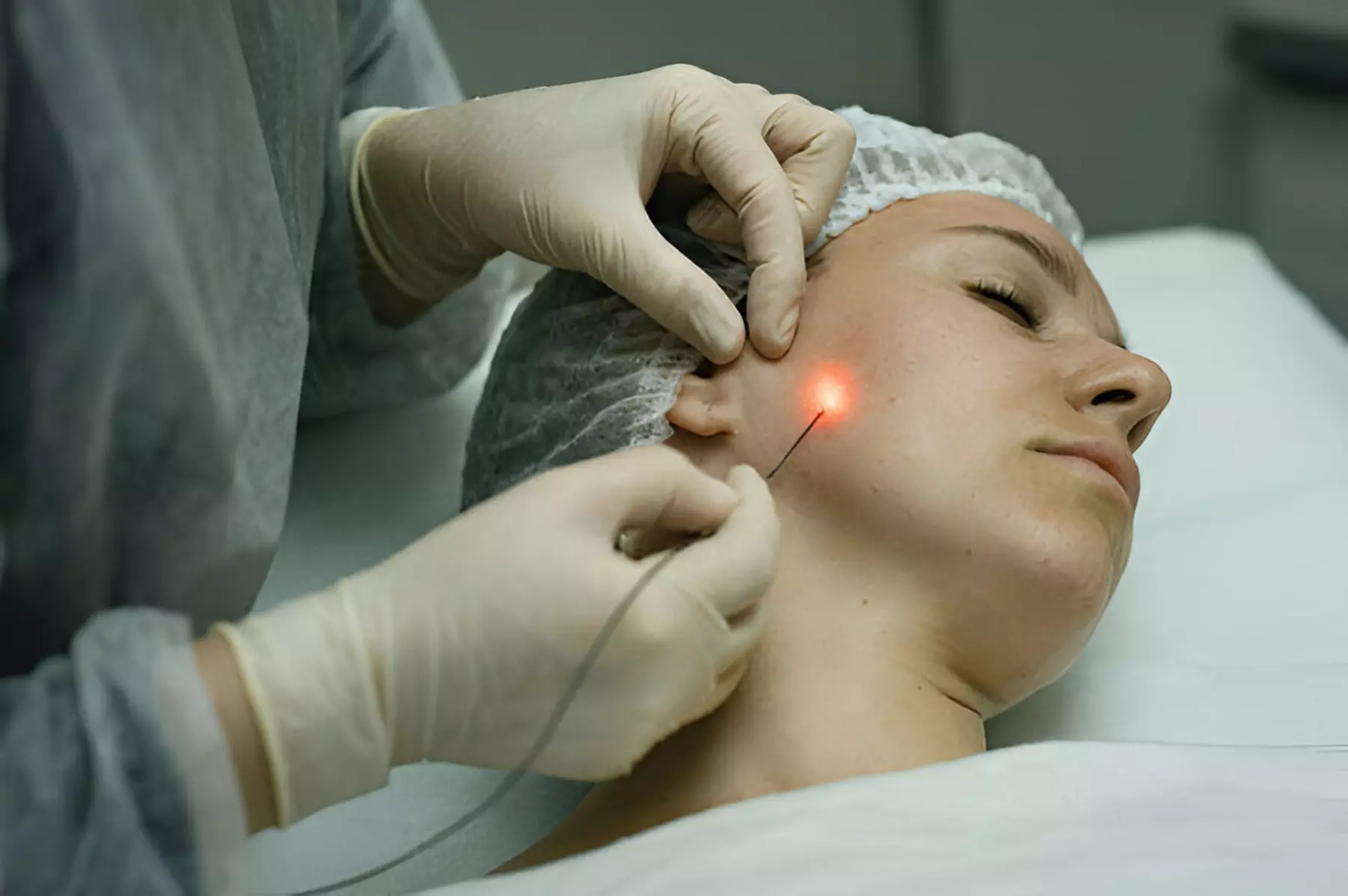 Up to 50% Off on Facelift - Non-Surgical at Leevision Ophthalmology Services