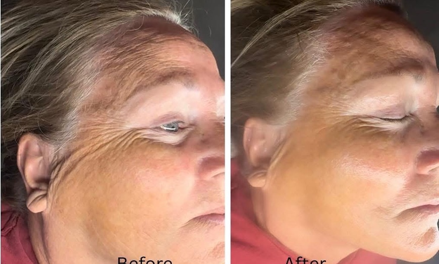 Image 4: Up to 30% Off on Eyebrow Tinting at A.Esthetics