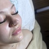 Image 2: Up to 53% Off on Microdermabrasion at Face Forward Esthetics