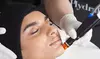 Up to 42% Off on HydraFacial at Your Skin & I Aesthetics (Previously known as Skin By Jess)