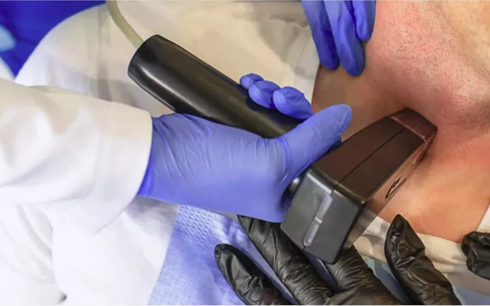 Single or Two Morpheus8 Sessions - Full Face & Neck