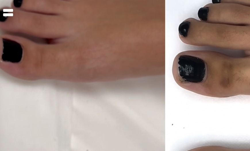 Image 2: One or Three-Hour Scar Camouflage Tattoo Services with Consultation