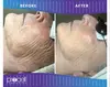 Rejuvenate with Procell Therapies: Face & Neck or Stretch Marks & More (Up to 37% Off) at Nouveau Toi Med Spa