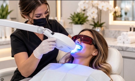 One In-Office Teeth Whitening Session - Golden Aura Salon