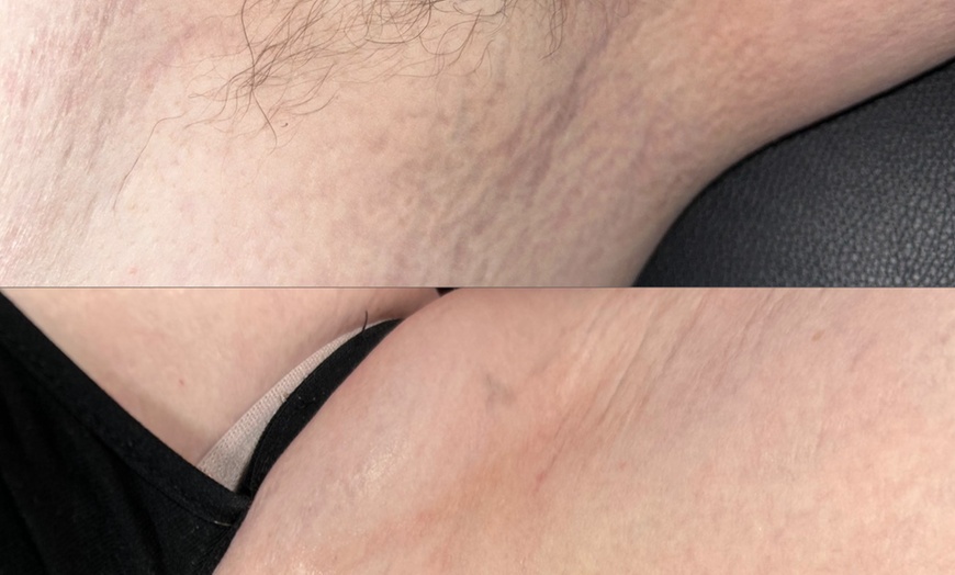 Image 4: Women’s Brazilian, Back & Full Leg Waxing for Smooth Skin