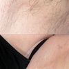Image 4: Women’s Brazilian, Back & Full Leg Waxing for Smooth Skin