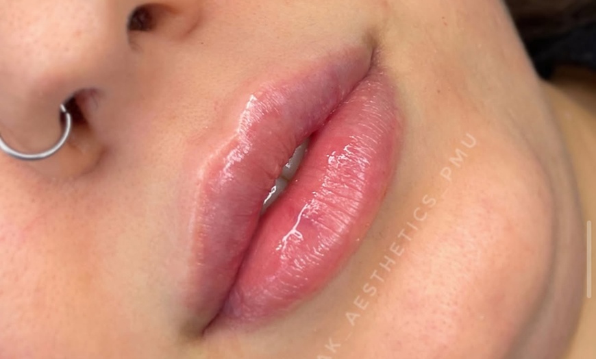 Image 1: Up to 60% Off on Injection - Dermal Filler at La Bella Beauty Bar