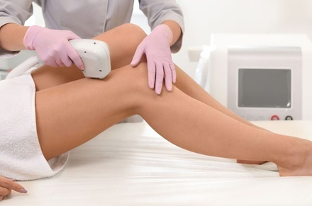 One Laser Hair Removal Sessions for One Medium Area  (Trial) - Akala Med Spa
