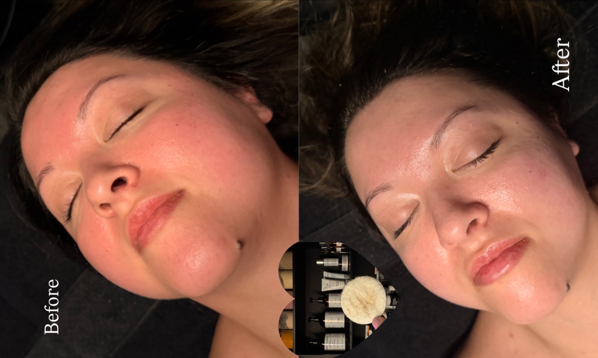 Divine Aura Esthetics: 1, 2, or 3 - 60-Min Dermaplaning Facials with Manual Lymphatic Massage (Up to 60% Off)