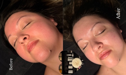 One Dermaplaning Facial with Manual Lymphatic Massage (60 min) - Divine Aura Esthetics